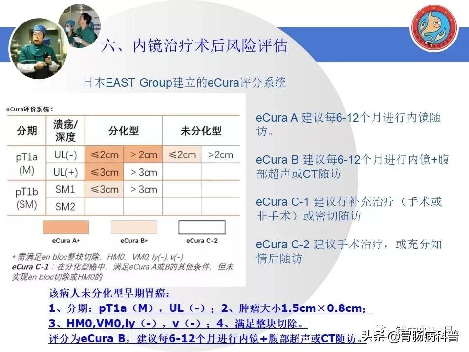 胃癌可以做内镜手术吗,早期胃癌内镜手术后追加外科手术