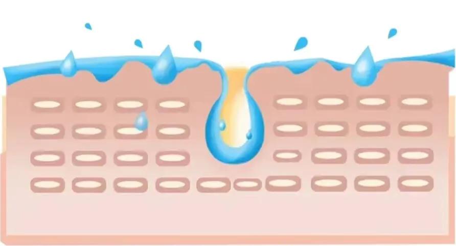 皮肤外干内油腻怎么护肤,皮肤外油内干怎么化妆
