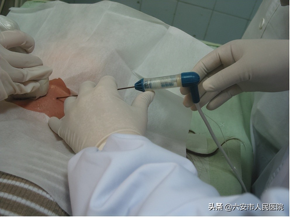 不用开刀也能治疗甲状腺结节？六安市人民医院这项技术了解一下
