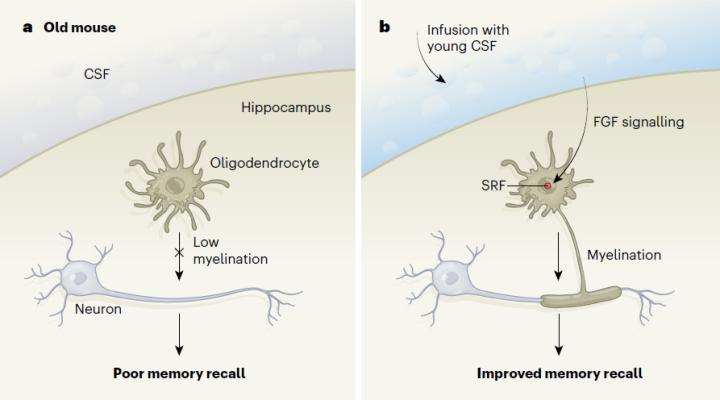 脑科学阿尔茨海默,有关阿尔茨海默症的科普文章