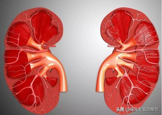 尿酸高的七个征兆官方,尿酸高都有什么前期征兆