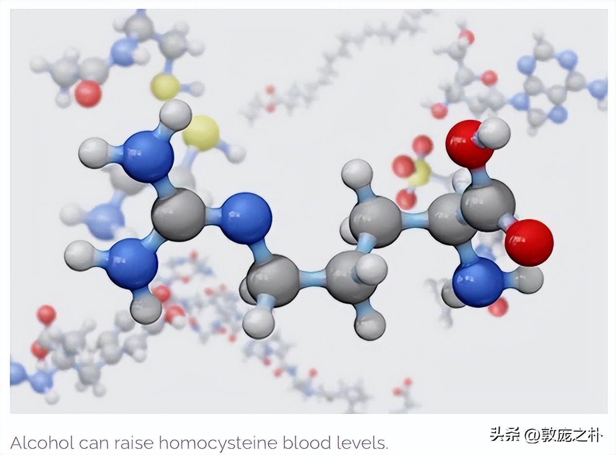 血液检验同型半胱氨酸高怎么回事 (高同型半胱氨酸血症算血液异常不)