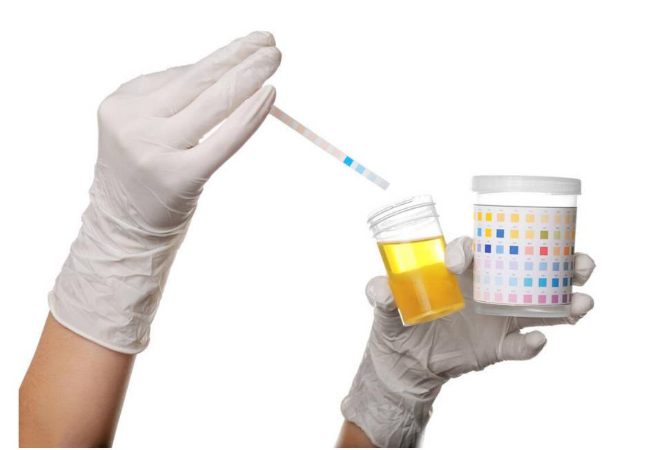 尿酸偏高在睡觉时会发生什么,尿酸高晚上睡觉有四种表现