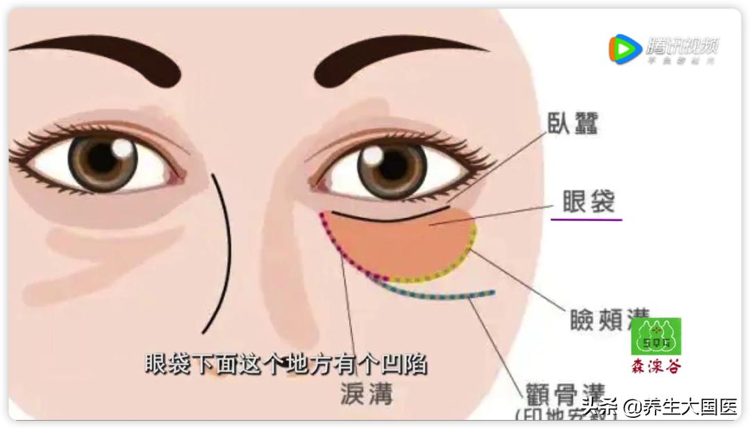 对付眼袋有良方,中年人的眼袋2分钟解决
