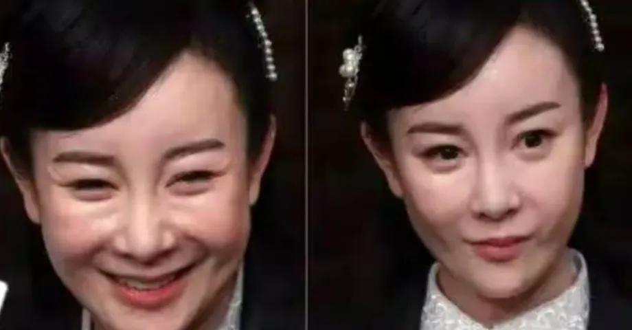 整容失败的明星张檬后悔吗,整容变毁容的女星张檬