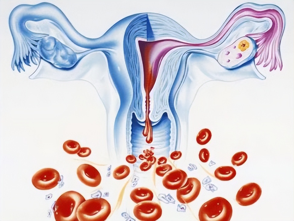 来例假时排出一团血块是怎么回事,来例假流出血块怎么回事