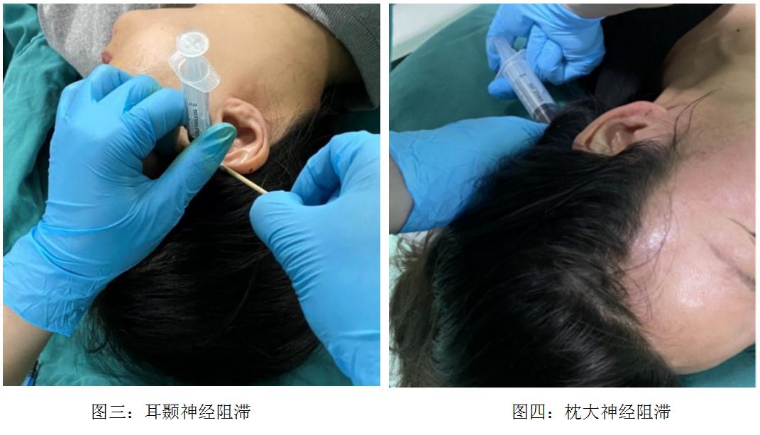 怎样治愈头痛失眠,快速缓解失眠头疼