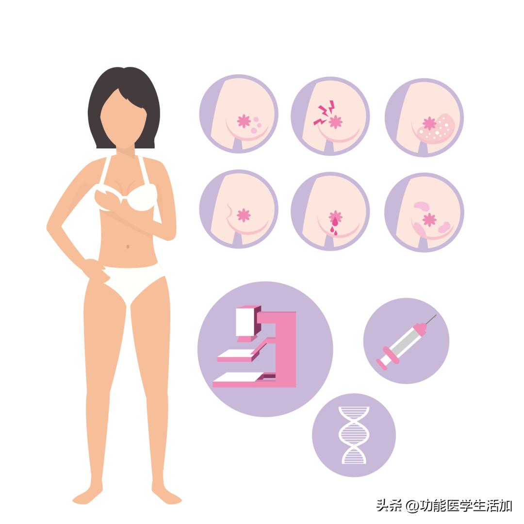 乳腺增生birads1类需要治疗吗,乳腺增生治疗费用大概多少