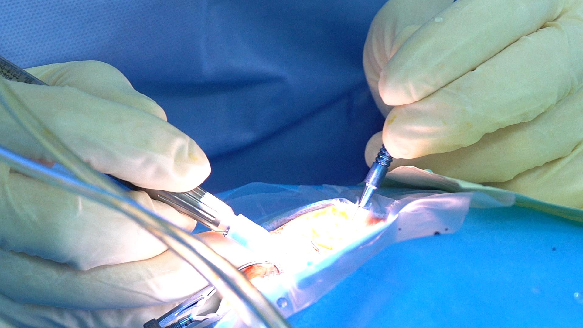 丝路盛放洋紫荆|港NGO联手内地医疗队出海扫“盲”50年柬埔寨白内障患者复明：我能看到了！