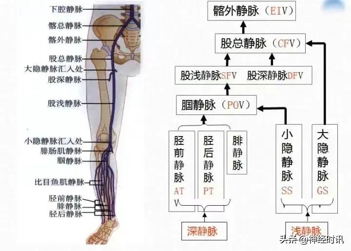 血栓用肝素抗凝管多久凝血,肌间静脉血栓需要绝对卧床吗