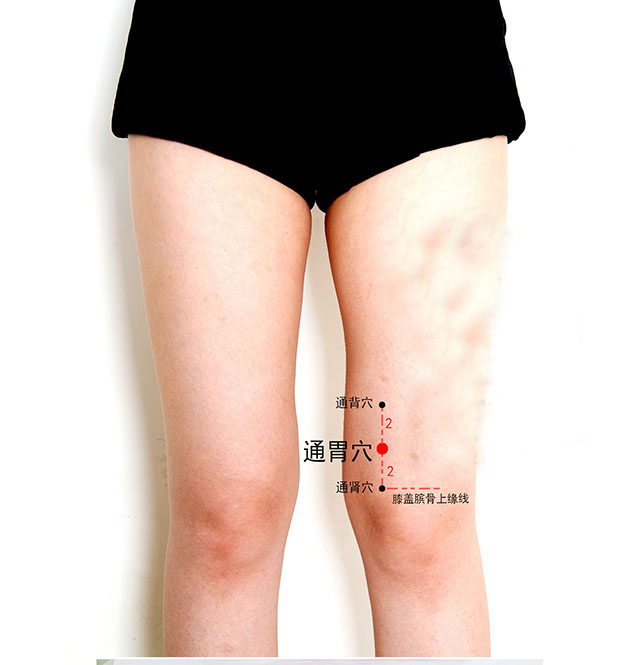 泌尿系疾病针灸,泌尿系统感染针灸哪里最有效