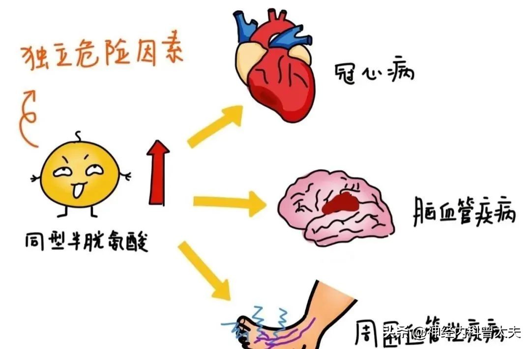 预防脑中风吃什么药有效果,防治脑卒中为什么要降血脂