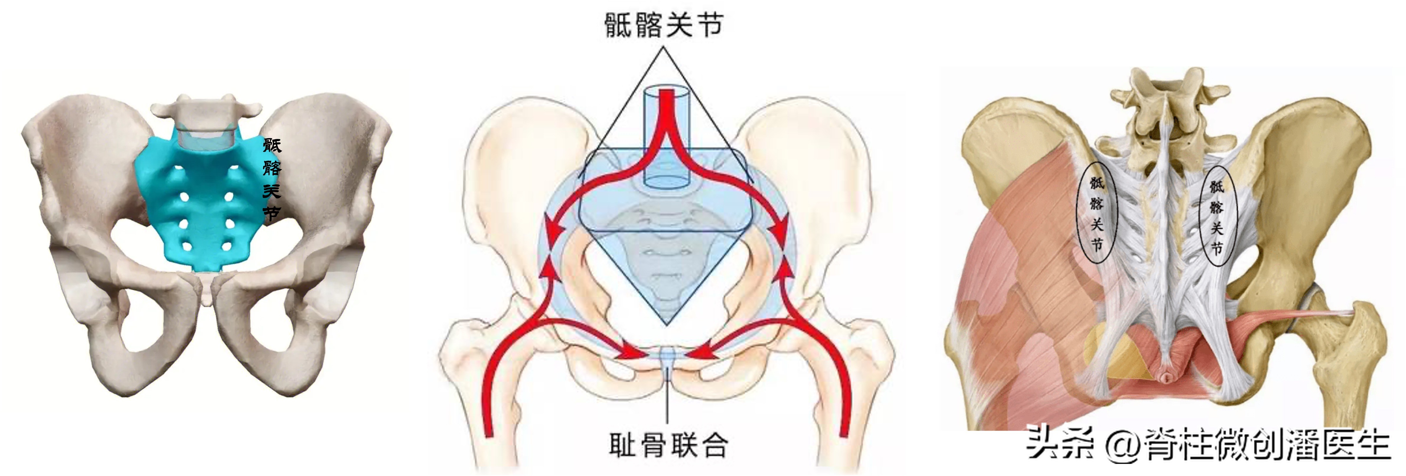 骶髂关节痛最好的锻炼方法,打喷嚏骶髂关节痛怎么回事