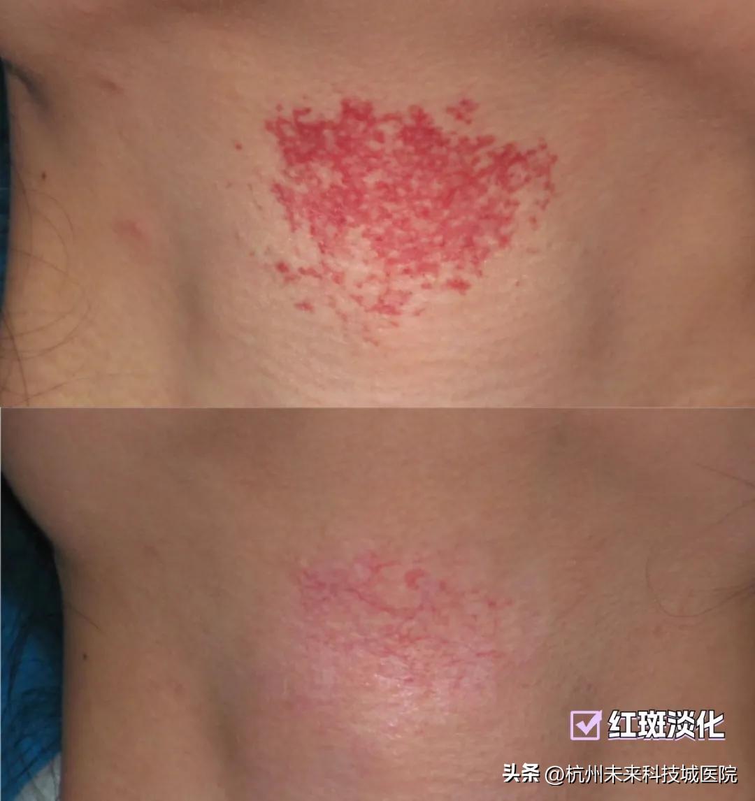 不追求一个模板的复制美|17年专注年轻化专家