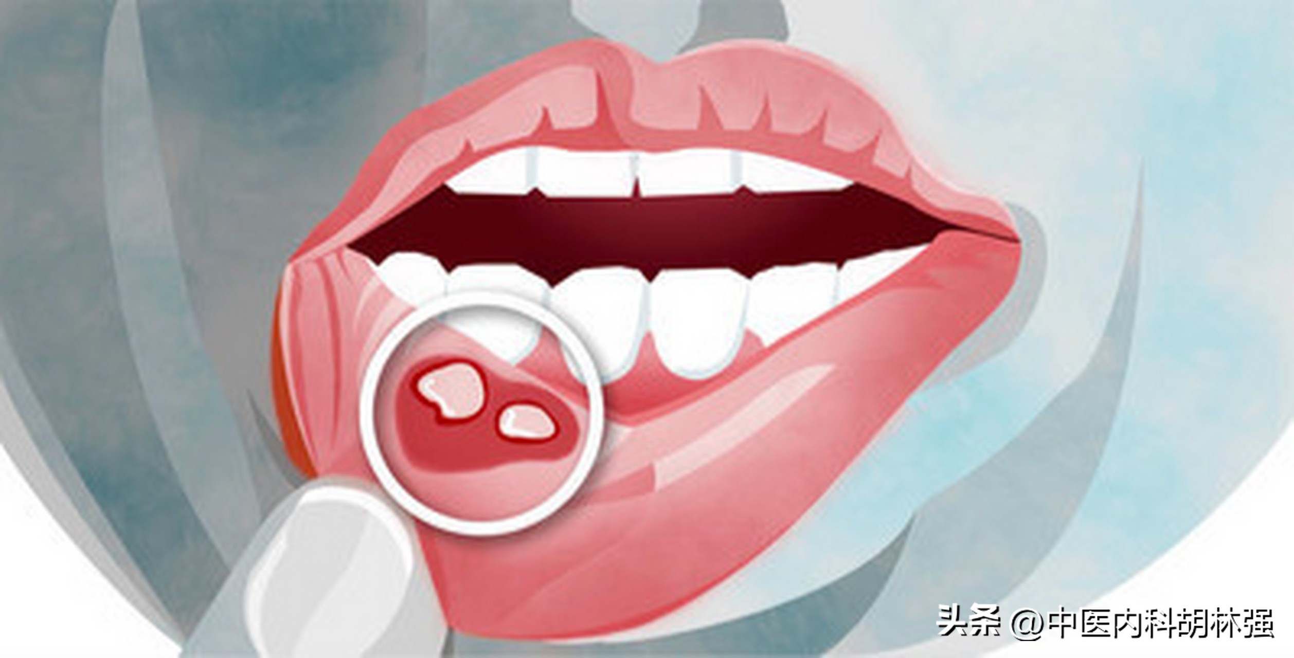 片仔癀黄金,中药片仔癀的功效及价格