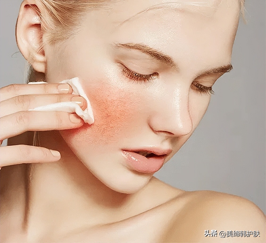 红血丝敏感肌夏天怎么护肤,敏感肌的正确护肤方法