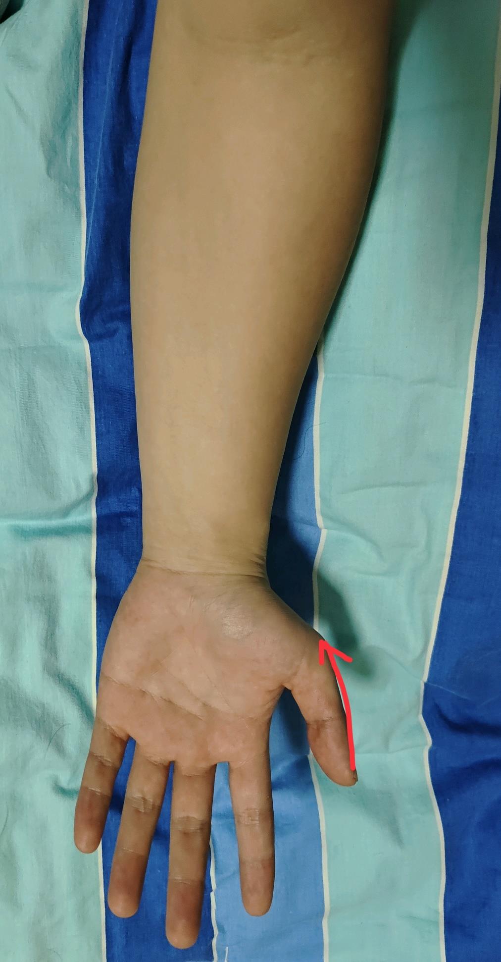 宝宝便秘拉的便便有粘液,宝宝便秘拉绿色的便便是什么原因