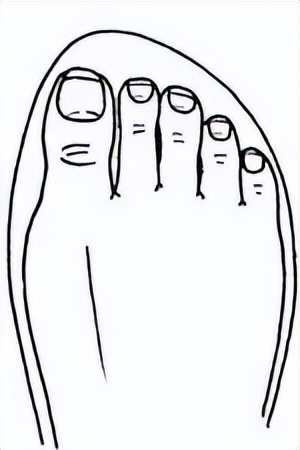 被石头划伤肿了,被石头划伤了肿了怎么办