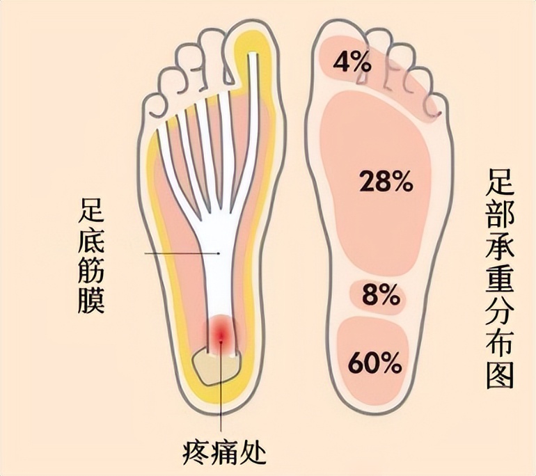 有什么方法舒缓足底疼痛,足底疼痛的原因和治疗方法