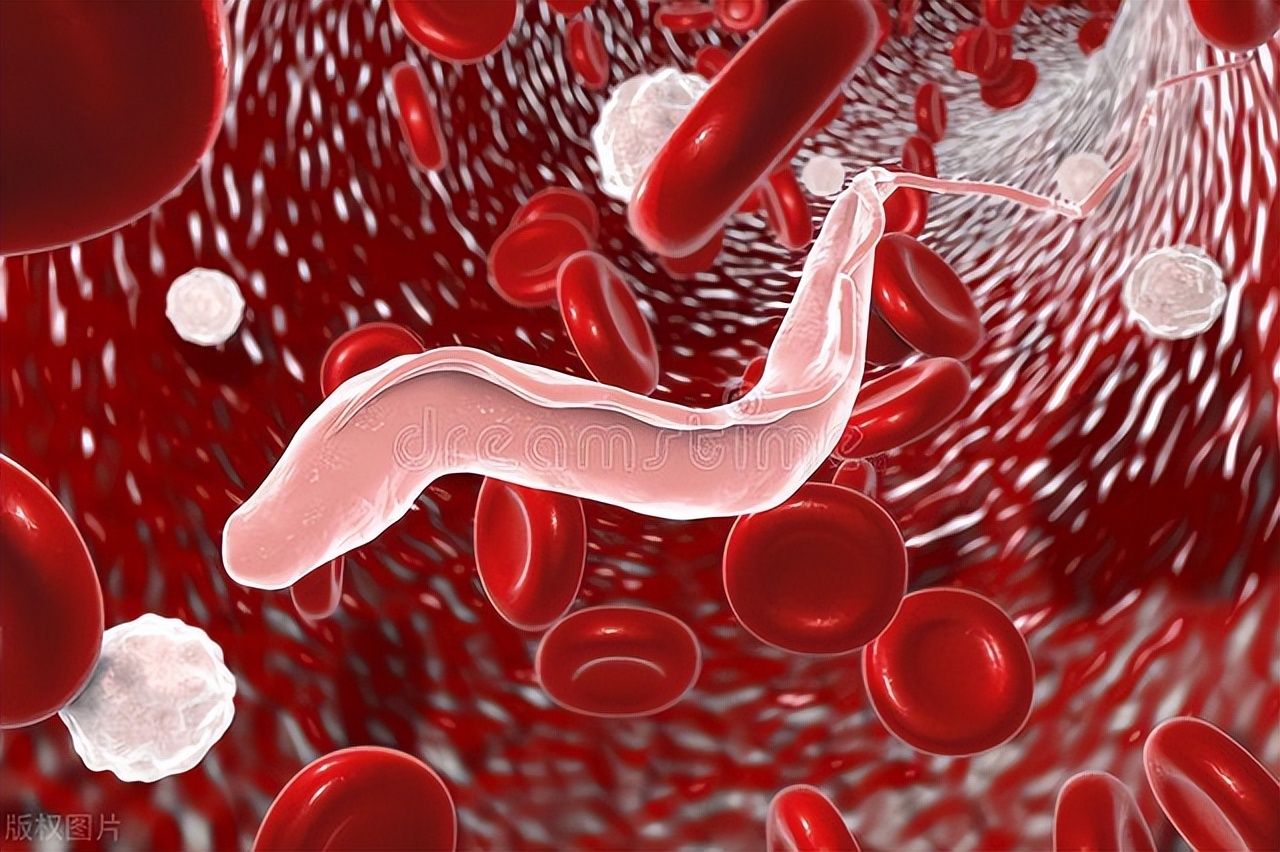 女性私密处瘙痒是怎么回事？可能是得了阴道炎，和4个原因有关