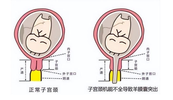 不肚疼有褐色出血会不会流产,怀孕不见红不腹痛会流产吗