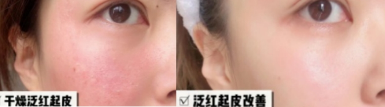 clarins适合孕妇的水乳,孕妇可以用的水乳有哪几个品牌