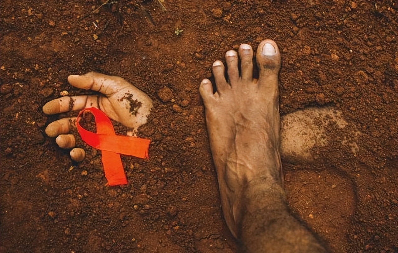 感染艾滋病毒后，你还能活多久？