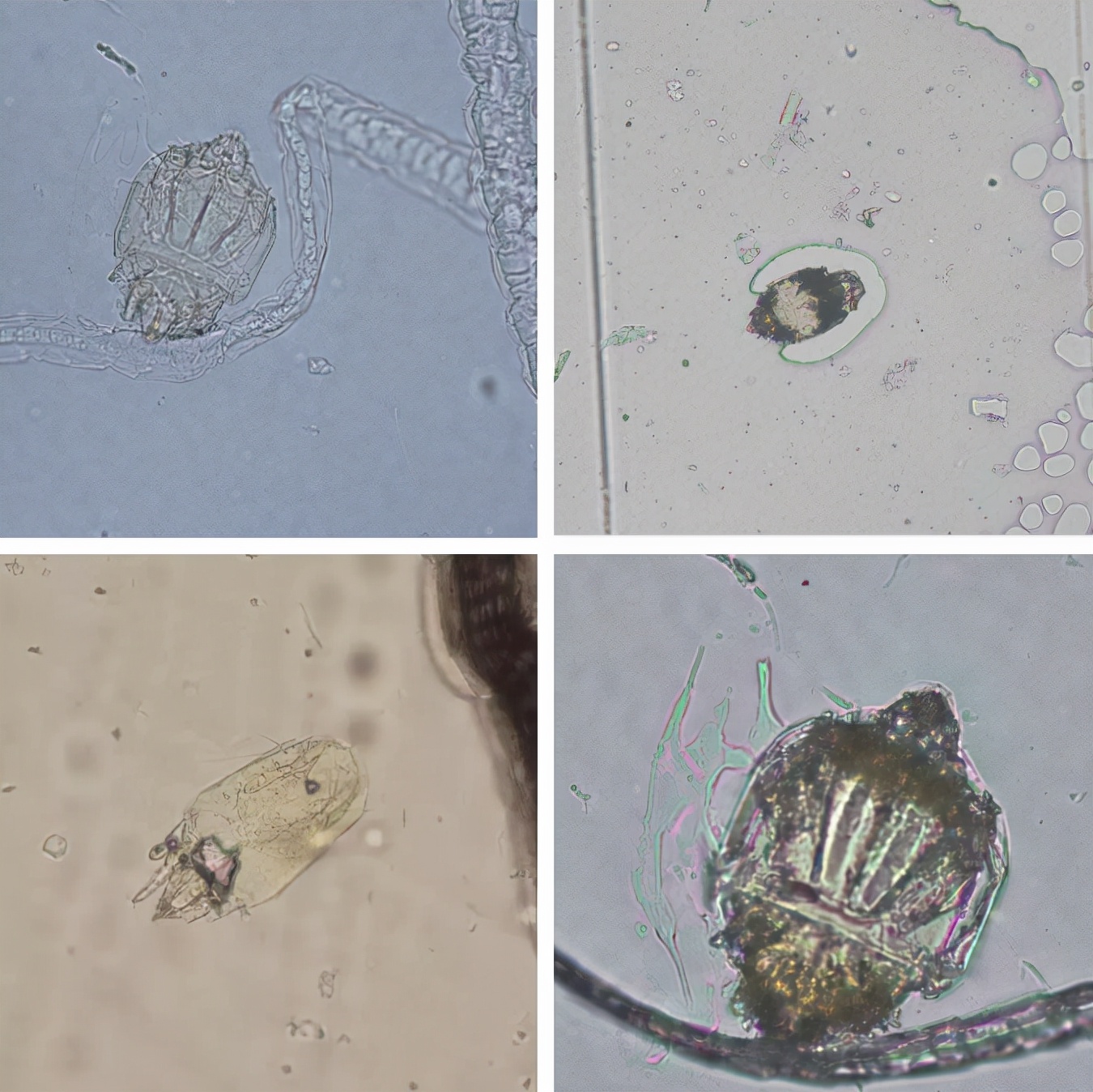螨虫有活螨和死螨吗,真假红蜘蛛