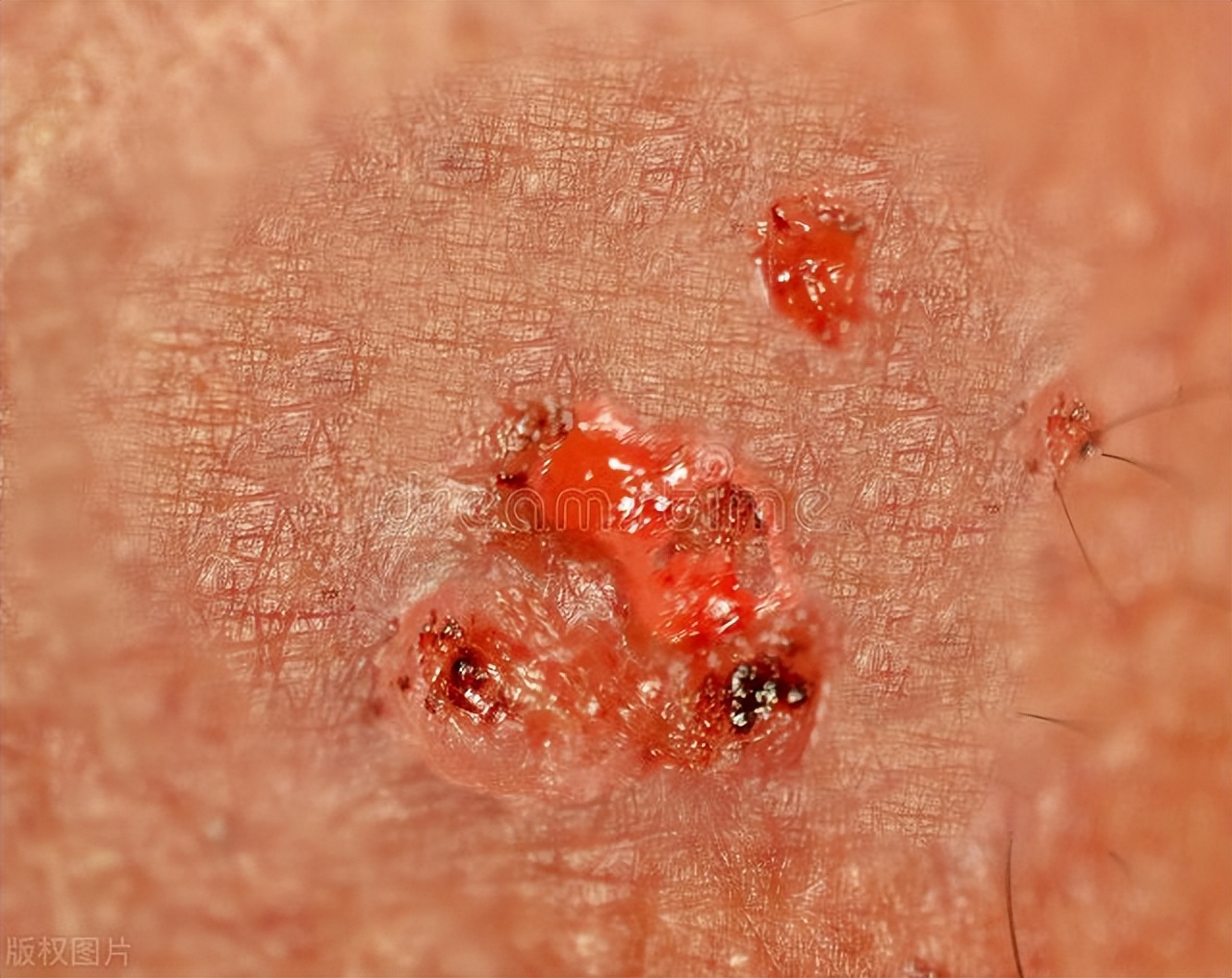 正经科普：为何头发、眉毛都是直的，可“那里”的毛却是卷的？