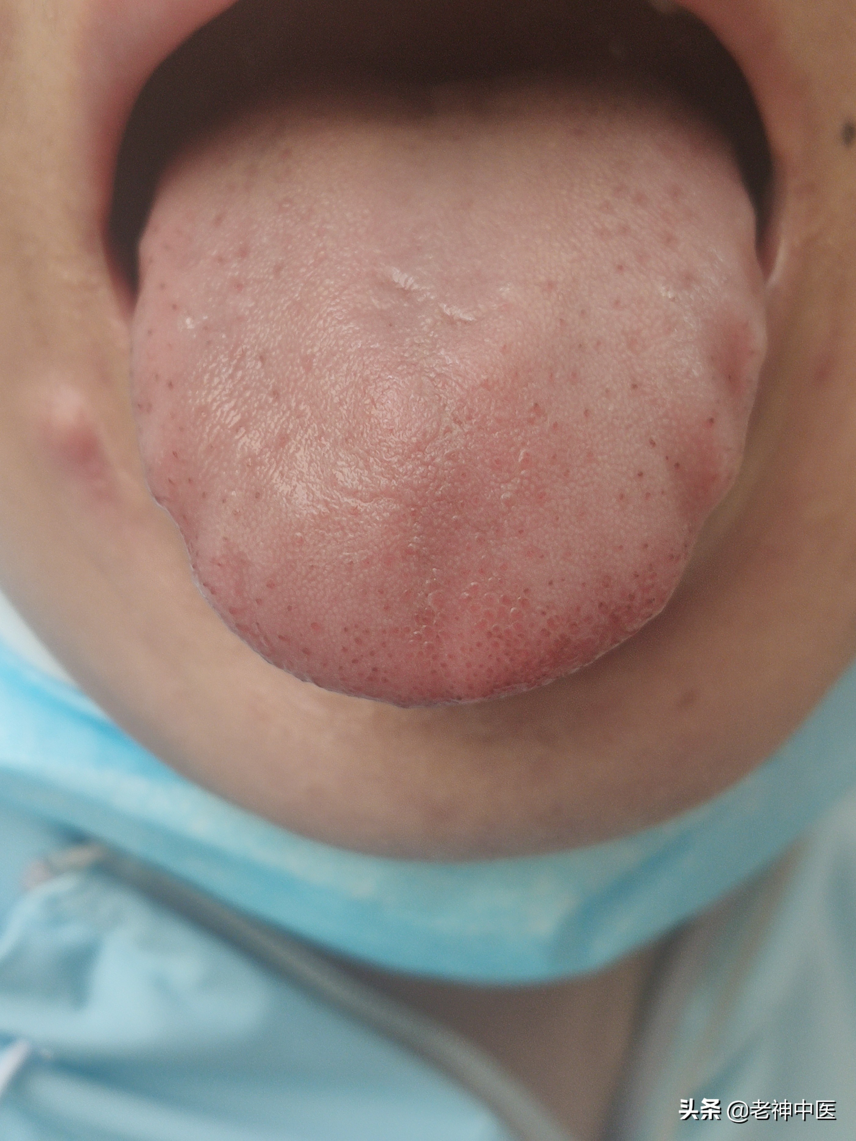 糖尿病引起刺痛怎么办,糖尿病刺痛感怎么治疗