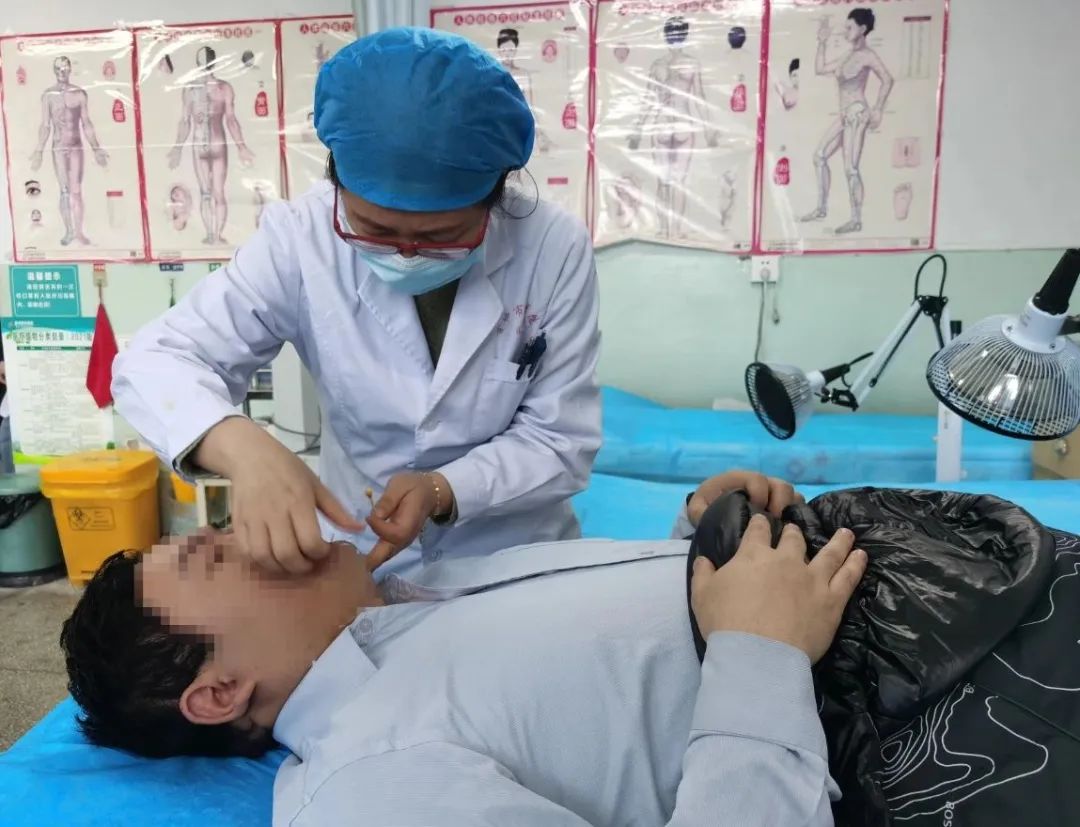 一附属哪个医生针灸治面瘫比较好,中医院针灸科治面瘫谁好