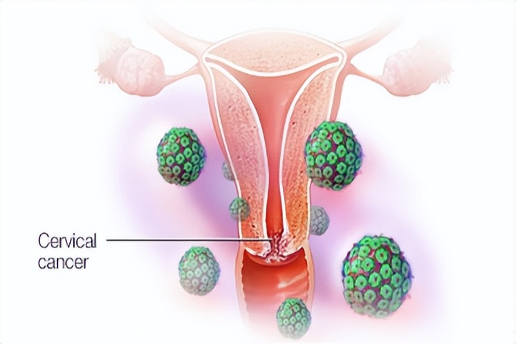 临汾市人民医院宫颈筛查,女神节体检团购