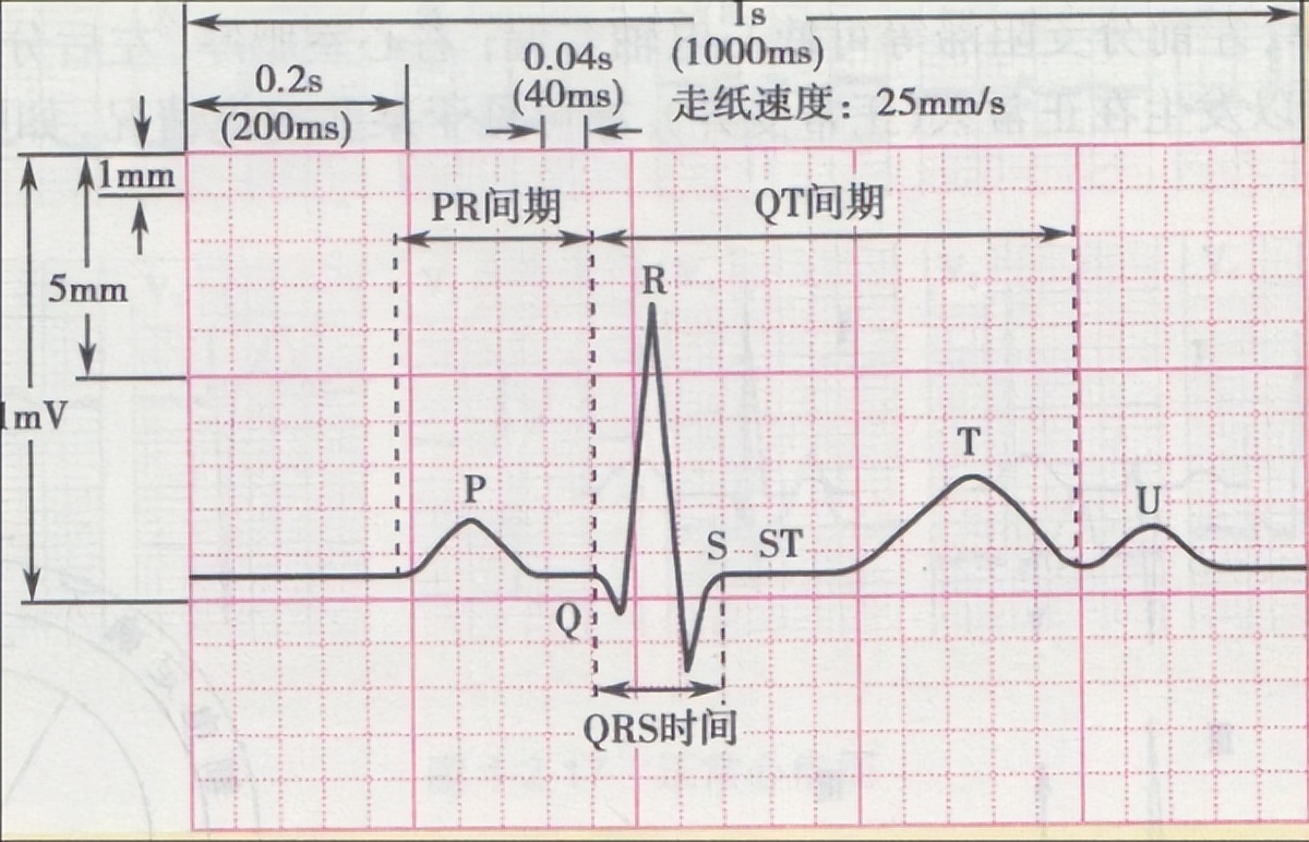 患者男59岁反复胸闷,患者男性59岁因心悸持续一小时