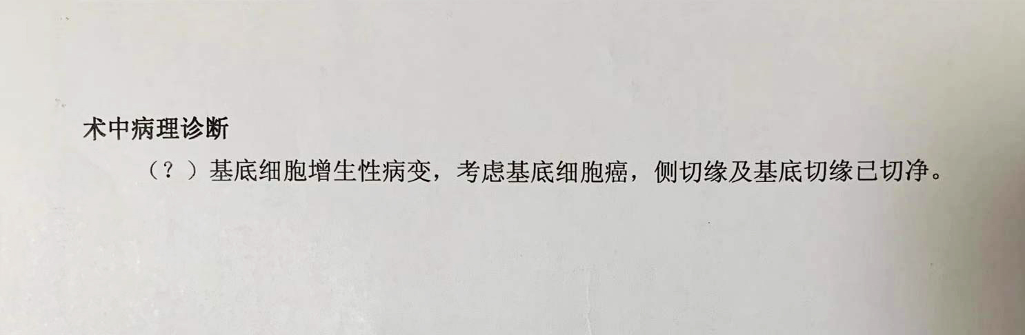 术前长发被齐根剪下，术后我又失去了一块头皮
