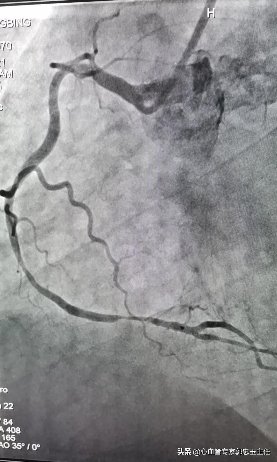 彩超心脏检查能查到心包疾病吗,心脏彩超检查哪些疾病
