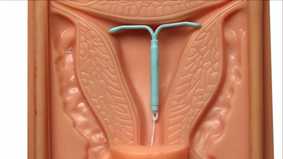 药流伤身,药流副作用大还是人流副作用大