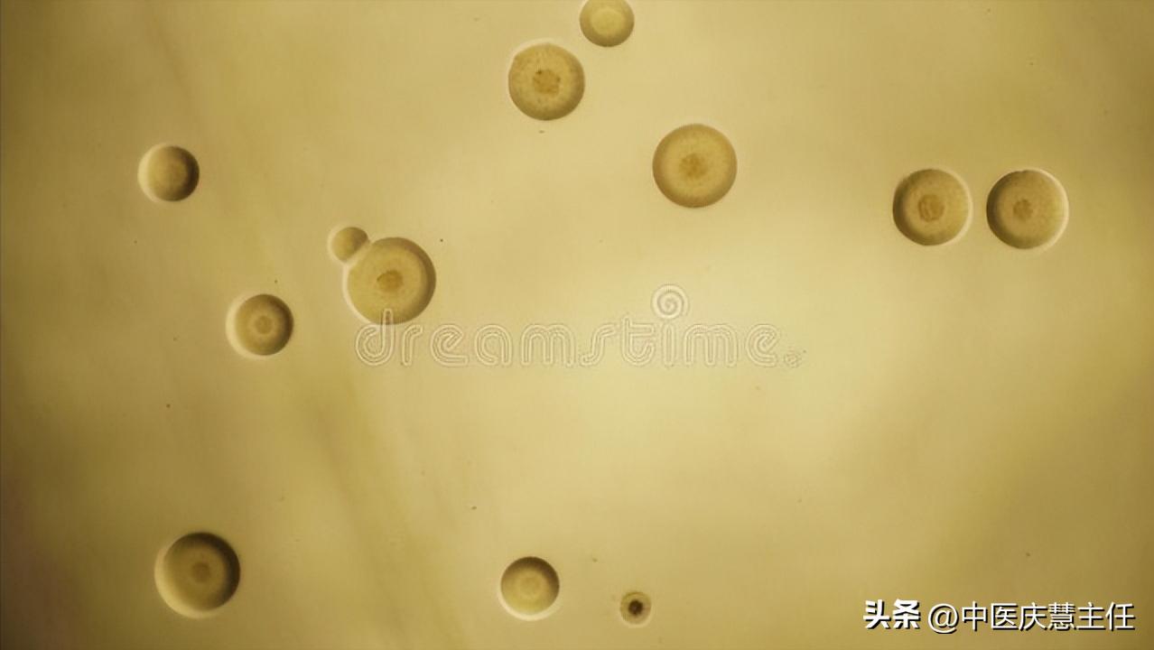 解脲支原体阳性有什么中药治疗,解脲支原体阳性治疗期间的饮食