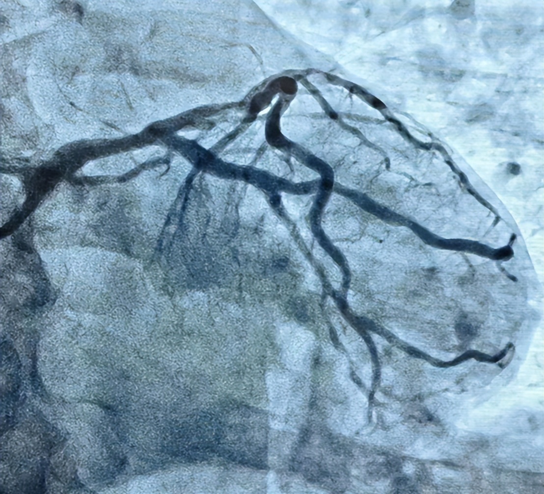 如何成为心内科医生,心内科医生养成记