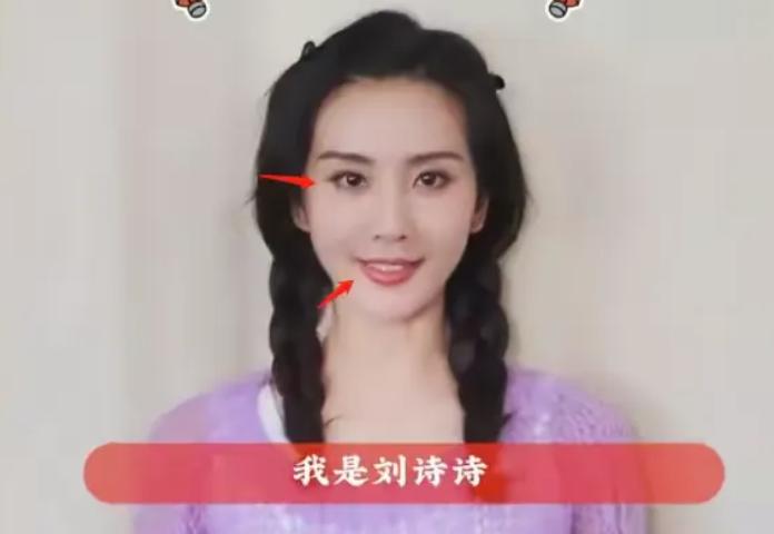 整容失败的女星蛇精脸,女星整容失败脸歪嘴斜