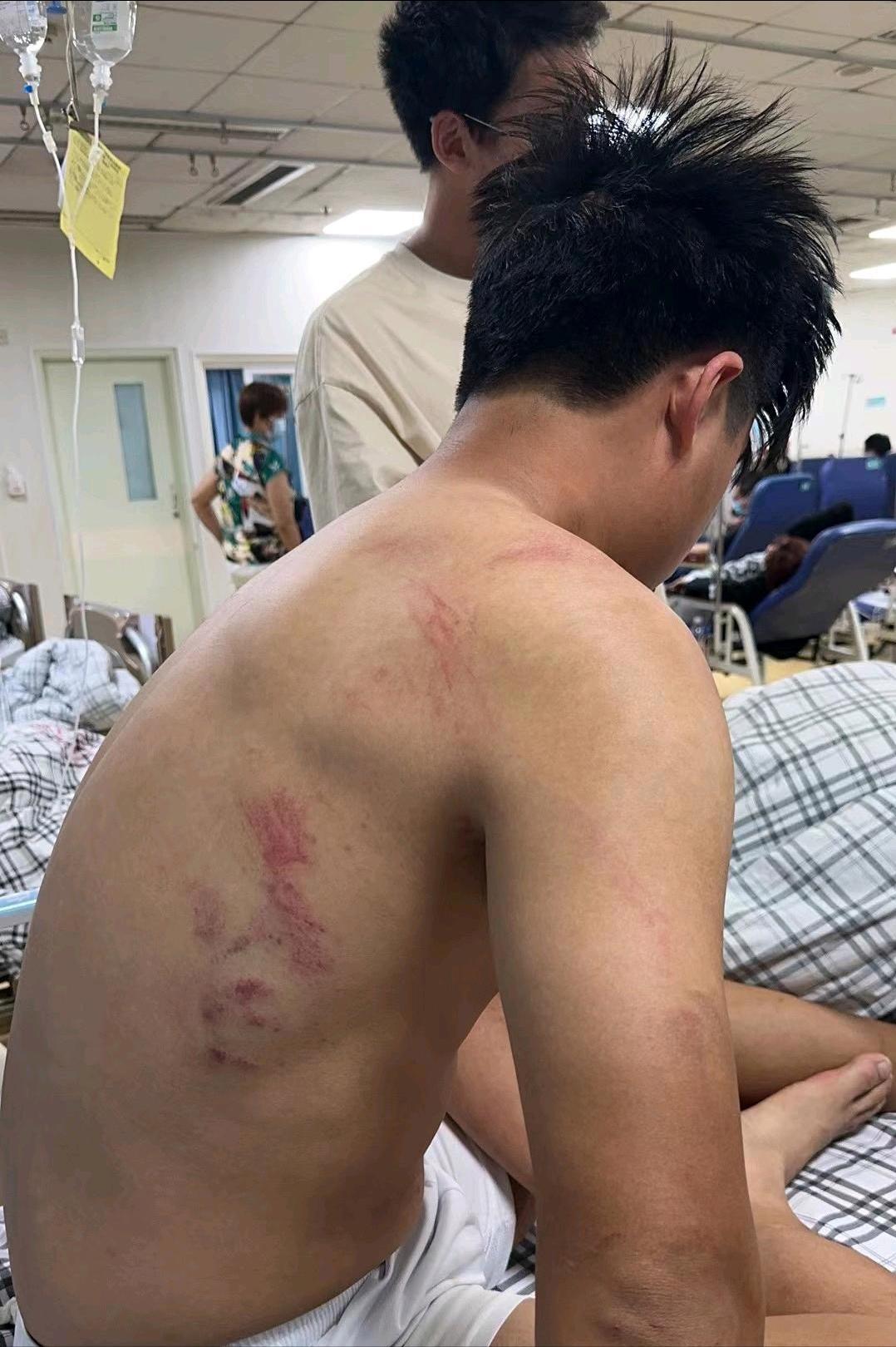 湖北大学冲突事件后续打人者,校霸挑衅体育生被群殴