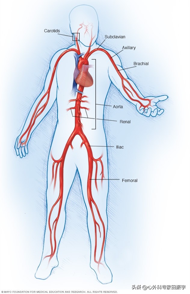 大动脉炎是血管出现了什么问题,大动脉炎是吃什么引起的吗