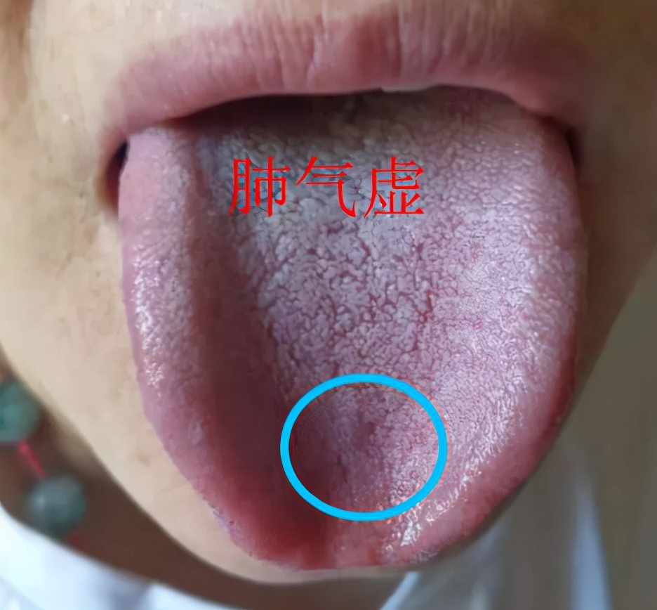 人过50岁后总没劲?多半是气虚!中医告诉你如何调理