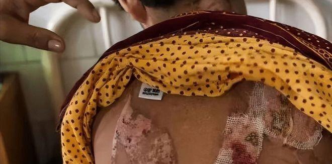 缅北套路深，我想回农村，9个孩子被骗缅甸遭电击开水烫