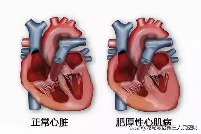 运动心率保持在多少对心脏有好处,每天运动30分钟对心脏好吗