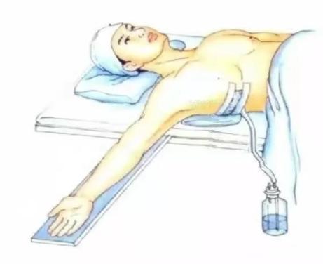 气胸插管排气后呼吸依然很痛,气胸呼吸时咯吱响