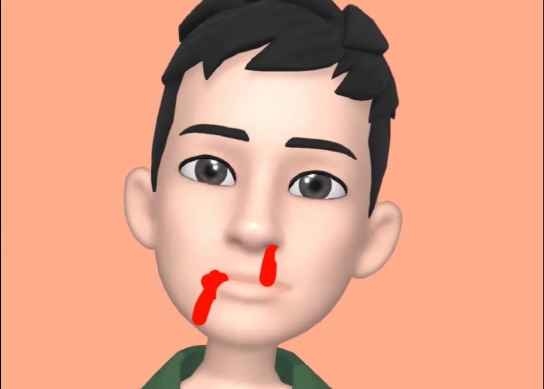 当被打时该怎么防卫,当被人打时怎样反击