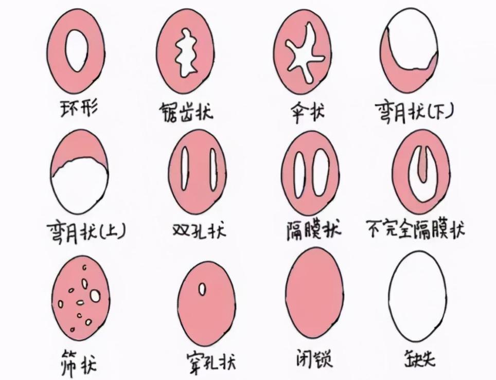 同房过后，女性下半身疼痛是咋回事？医生提醒：可能是这3个原因