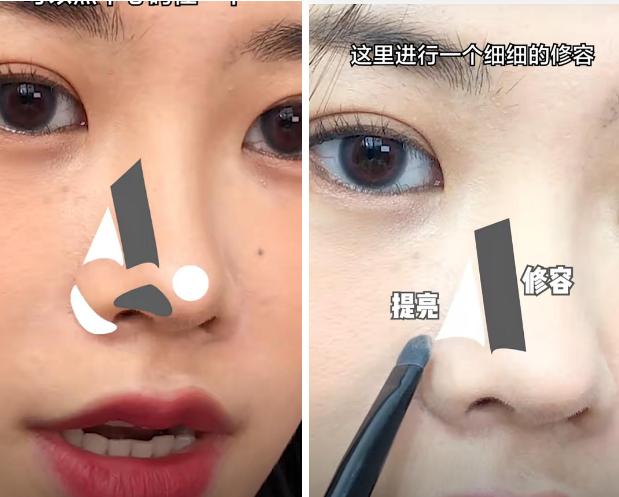 塌鼻子变美思路看这里,塌鼻梁怎么变漂亮