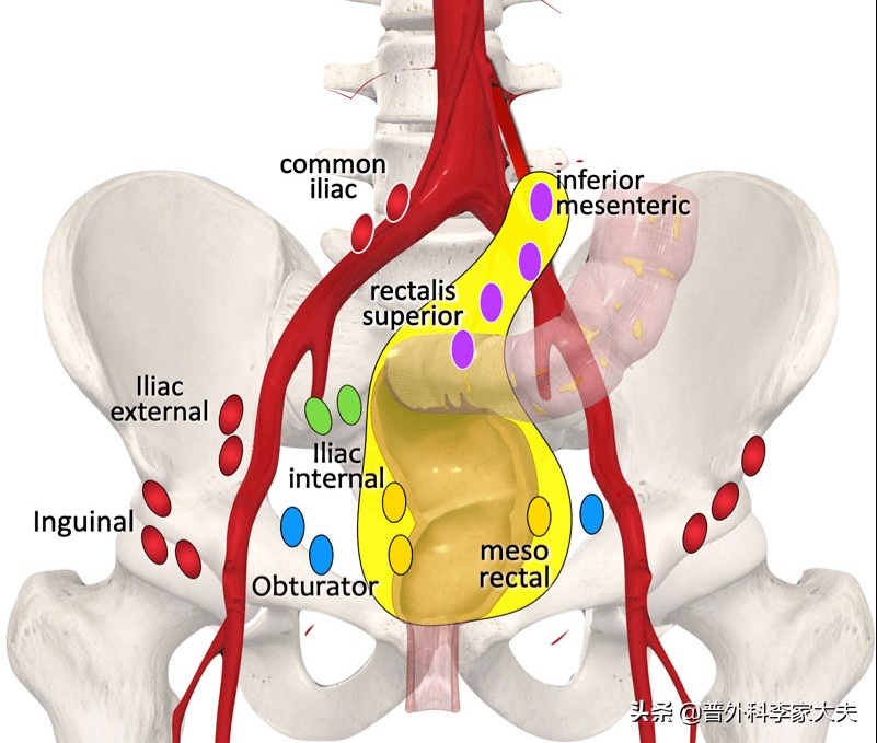 直肠癌t3n1m0术前放化疗,肛管癌ct3n2m0治愈率