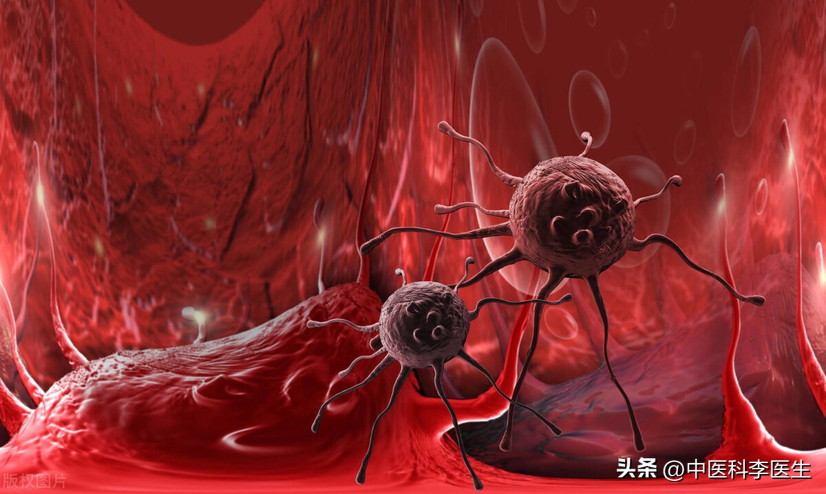 早期17种癌症治愈率排名,早期癌症治愈率最大可达95%以上